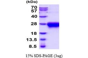 SDS-PAGE (SDS) image for Activin A Receptor, Type IIA (ACVR2A) (AA 20-135) protein (His tag) (ABIN5854601)