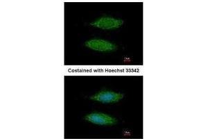 ICC/IF Image Immunofluorescence analysis of methanol-fixed HeLa, using LOC283129, antibody at 1:200 dilution. (C11orf85 anticorps  (Center))