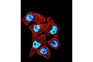 Immunofluorescence analysis of Hela cells using CTNNBL1 mouse mAb (green).