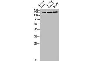 Western blot analysis of mouse-lung mouse-heart 293T lysis using CEP135 antibody. (CEP135 anticorps  (C-Term))
