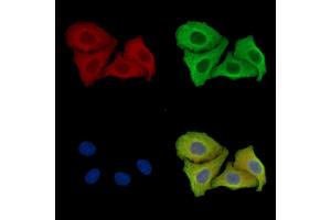 ABIN7097003 and ABIN7101070 staining Hela cells by IF/ICC. (GAPVD1 anticorps)