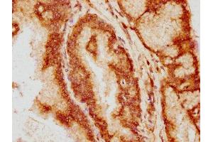 anti-B-Cell CLL/lymphoma 9 (BCL9) (AA 231-340) antibody