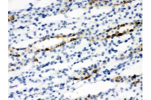 Anti-SLC9A2 antibody, IHC(P) IHC(P): Rat Kidney Tissue (SLC9A2 anticorps  (C-Term))