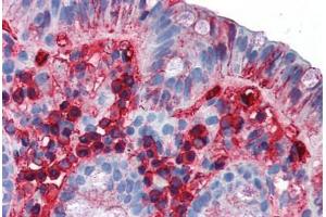 Human Colon (formalin-fixed, paraffin-embedded) stained with IgA antibody ABIN337297 at 10 ug/ml followed by biotinylated anti-mouse IgG secondary antibody ABIN481714, alkaline phosphatase-streptavidin and chromogen. (Souris anti-Humain IgA Anticorps)