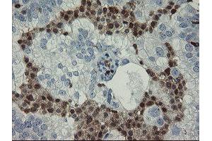 Image no. 2 for anti-GTPase, IMAP Family Member 4 (GIMAP4) antibody (ABIN1498460)