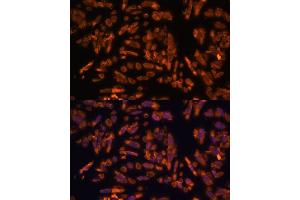 Immunofluorescence analysis of U-2 OS cells using PRX antibody (ABIN7269215) at dilution of 1:100. (Periaxin anticorps  (AA 1250-1350))