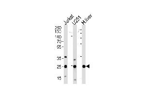 Western blot analysis of lysates from Jurkat, U251 cell line and human liver tissue (from left to right), using GSTM1 Antibody at 1:1000 at each lane. (GSTM1 anticorps  (C-Term))