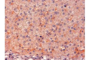 ABIN185487 (2µg/ml) staining of paraffin embedded Human Liver. (ENPP1 anticorps  (C-Term))