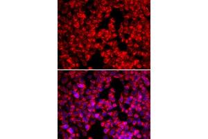 Immunofluorescence analysis of U20S cell using MTTP antibody.