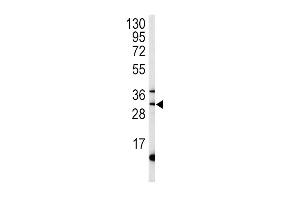 Western blot analysis of ST antibody (C-term) (ABIN392001 and ABIN2841786) in mouse liver tissue lysates (35 μg/lane). (MPST anticorps  (C-Term))
