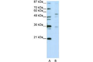 WB Suggested Anti-ZNF57 Antibody Titration:  5. (ZFP57 anticorps  (C-Term))