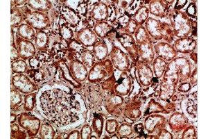 Immunohistochemical analysis of paraffin-embedded human-kidney, antibody was diluted at 1:200 (IMP3 anticorps  (AA 135-184))