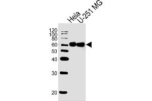 Lane 1: HeLa Cell lysates, Lane 2: U-251 MG Cell lysates, probed with FUBP3 (1216CT820. (FUBP3 anticorps)