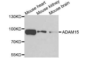 Western blot analysis of extracts of various cell lines, using ADAM15 antibody. (ADAM15 anticorps)