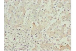 Immunohistochemistry of paraffin-embedded human liver tissue using ABIN7143434 at dilution of 1:100 (ADPGK anticorps  (AA 218-497))