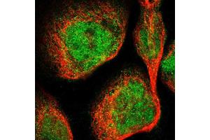 Immunofluorescent staining of A-431 cells using DGKE polyclonal antibody  shows positivity in cytoplasm and nucleus (green) but excluded from the nucleoli. (DGKE anticorps  (AA 63-192))