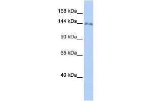 WB Suggested Anti-ZNF862 Antibody Titration:  0. (ZNF862 anticorps  (N-Term))