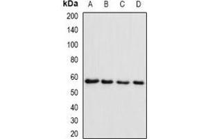 Western blot analysis of SMYD1 expression in Raji (A), MCF7 (B), mouse skeletal muscle (C), rat heart (D) whole cell lysates. (SMYD1 anticorps)
