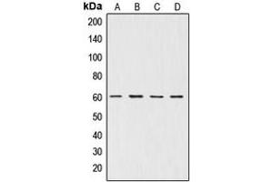 Western blot analysis of AKT expression in A549 (A), NIH3T3 (B), mouse brain (C), rat brain (D) whole cell lysates. (AKT1 anticorps  (Center))