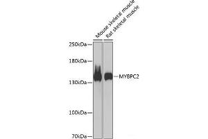 Western blot analysis of extracts of various cell lines using MYBPC2 Polyclonal Antibody at dilution of 1:1000. (MYBPC2 anticorps)