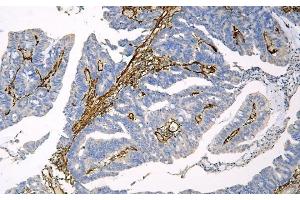 IHC analysis of Caveolin-1/CAV1 using anti-Caveolin-1/CAV1 antibody (ABIN6719534). (Caveolin-1 anticorps  (AA 4-178))