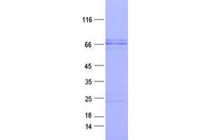 Validation with Western Blot