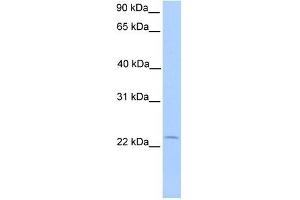 C5ORF39 antibody used at 1 ug/ml to detect target protein. (Chromosome 5 Open Reading Frame 39 (C5orf39) (N-Term) anticorps)