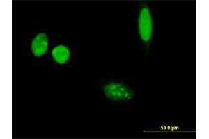Immunofluorescence of purified MaxPab antibody to THSD3 on HeLa cell. (Isthmin 2 anticorps  (AA 1-483))