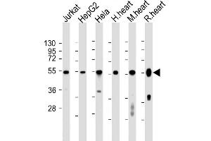 All lanes : Anti-OXCT1 Antibody (Center) at 1:2000 dilution Lane 1: Jurkat whole cell lysates Lane 2: HepG2 whole cell lysates Lane 3: Hela whole cell lysates Lane 4: human heart lysates Lane 5: mouse heart lysates Lane 6: rat heart lysates Lysates/proteins at 20 μg per lane. (OXCT1 anticorps  (AA 272-306))