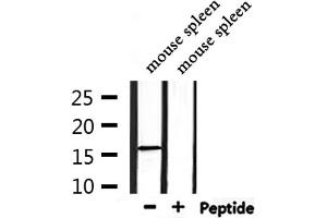 Western blot analysis of extracts from mouse spleen, using Substance P Antibody. (TAC1 anticorps  (Internal Region))