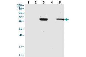 Western blot analysis of Lane 1: RT-4, Lane 2: U-251 MG, Lane 3: Human Plasma, Lane 4: Liver, Lane 5: Tonsil with C1RL polyclonal antibody . (C1RL anticorps)