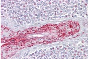 Anti-SLA antibody IHC staining of human spleen.
