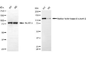 Western blotting analysis using nuclear factor kappa B subunit 2 antibody (ABIN7799635). (Recombinant NFkB anticorps  (Subunit 2))