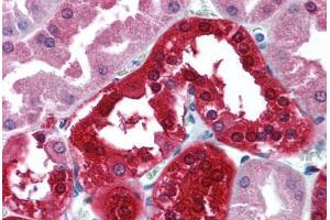 Human Kidney (formalin-fixed, paraffin-embedded) stained with CA2 antibody ABIN305738 at 5 ug/ml followed by biotinylated goat anti-rabbit IgG secondary antibody ABIN481713, alkaline phosphatase-streptavidin and chromogen. (CA2 anticorps  (HRP))