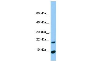 Host:  Rabbit  Target Name:  Timm17a  Sample Type:  Rat Pancreas lysates  Antibody Dilution:  1. (TIMM17A anticorps  (N-Term))