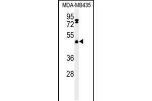Western blot analysis of FBXL2 Antibody in MDA-MB435 cell line lysates (35ug/lane) (FBXL2 anticorps  (C-Term))