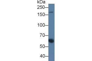 Detection of a2M in Porcine Serum using Monoclonal Antibody to Alpha-2-Macroglobulin (a2M) (alpha 2 Macroglobulin anticorps  (AA 616-856))