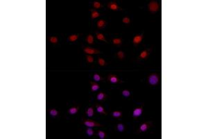 Immunofluorescence analysis of NIH/3T3 using SUPT16H (SPT16) antibody (ABIN7267097) at dilution of 1:100 (40x lens). (SUPT16H anticorps)