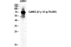Western Blot analysis of 22RV1 cells using Phospho-CaMKIIβ/γ/δ (T287) Polyclonal Antibody diluted at 1:500. (CaMKIIbeta/gamma/delta anticorps  (pThr287))
