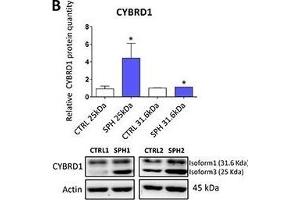 Expression of cytochrome b reductase (CYBRD1) and transferrin receptor 1 (TFR1) participating in iron uptake is higher in tumor-initiating cells (TICs)Expression of the CYBRD1 gene at the mRNA level in breast non-malignant cell line MCF10A, in TICs derived from breast cancer cell lines MCF-7, BT-474, T-47D and ZR-75-30 as well as from prostate cancer cell lines DU-145 and LNCaP has been determined (A) together with protein levels in the MCF-7 cell line (CTRL) and MCF-7 derived spheres (SPH) (B). (Cytochrome B Reductase 1 anticorps  (AA 51-150))