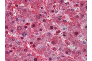 Immunohistochemical analysis of paraffin-embedded human Liver tissues using LPA mouse mAb (Lp(a) anticorps)