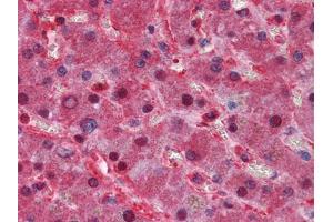 Immunohistochemical analysis of paraffin-embedded human Liver tissues using LPA mouse mAb (LPA anticorps)