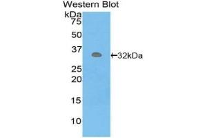 Detection of recombinant PCK1 using Polyclonal Antibody to Phosphoenolpyruvate Carboxykinase 1, Soluble (PCK1) (PCK1 anticorps  (AA 311-558))
