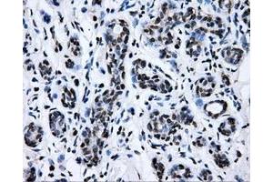 Immunohistochemistry (IHC) image for anti-RalA Binding Protein 1 (RALBP1) antibody (ABIN1500585)