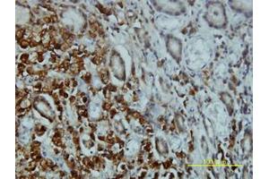 Image no. 2 for anti-serine/threonine Kinase 4 (STK4) (AA 1-40) antibody (ABIN598949) (STK4 anticorps  (AA 1-40))