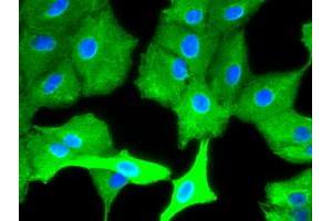 Image no. 2 for anti-Keratin 8 (KRT8) (AA 91-381) antibody (ABIN1491713)