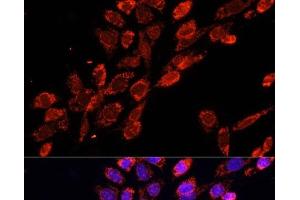 Immunofluorescence analysis of NIH/3T3 cells using EIF4EBP1 Polyclonal Antibody at dilution of 1:100. (eIF4EBP1 anticorps)