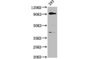 Western Blot Positive WB detected in: 293 whole cell lysate All lanes: DHX15 antibody at 3. (DHX15 anticorps  (AA 371-502))