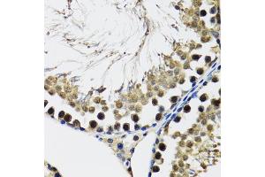 Immunohistochemistry of paraffin-embedded rat testis using DDX41 antibody (ABIN5973951) at dilution of 1/100 (40x lens). (DDX41 anticorps)