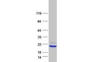 Validation with Western Blot